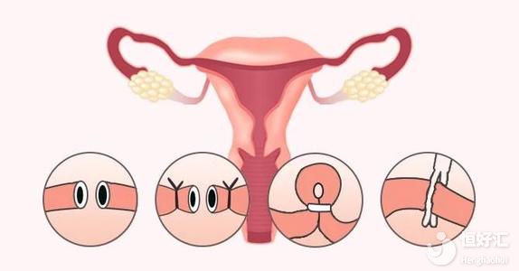 這5類女性在懷孕前請先檢查輸卵管，或許終身有益